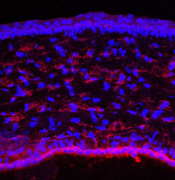 IF of P10 mouse cornea labeled with DSHB antibody CPTC-EPHB4-1 aginst EPH receptor B4 (red). Image credit Lachke Laboratory, University of Delaware